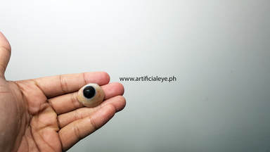 Artificial eye user in the Philippines